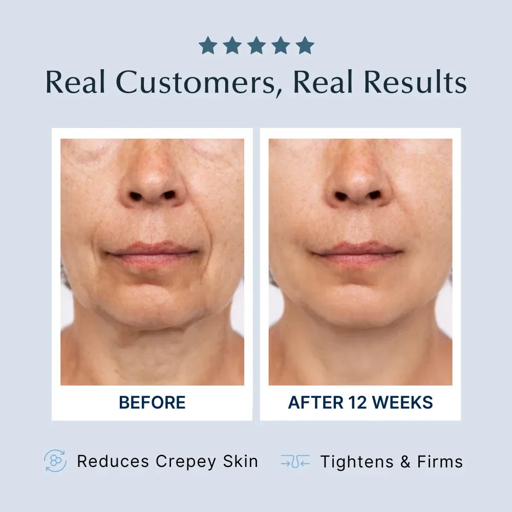 Crépe - Less Skin Firming Cream 4oz