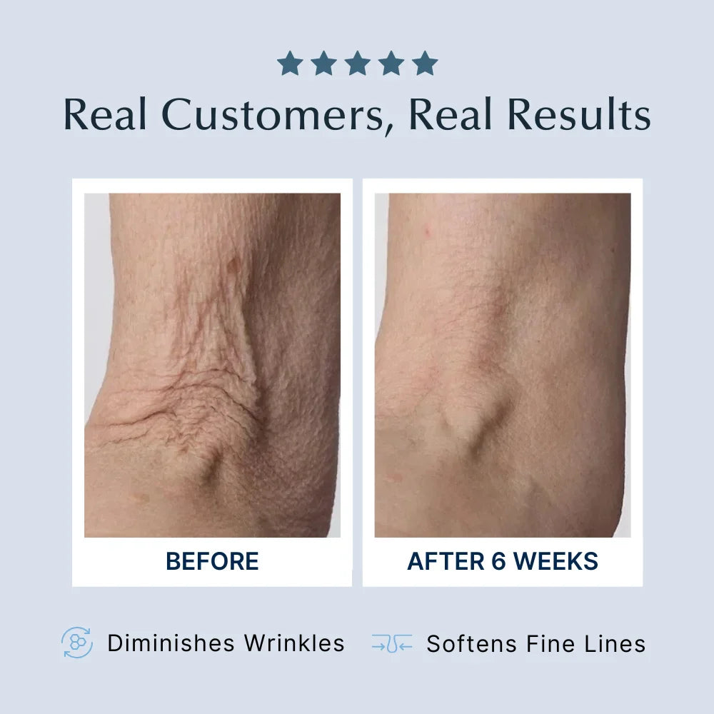Crépe - Less Skin Firming Cream 4oz